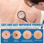 66 Pcs Skin Tag Remover Patch for Face and Body Painless Mole and Wart Removal Treatment thumbnail 2