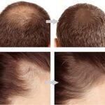 2in1 Hairline & Eyebrow Shaping Stamp thumbnail 3