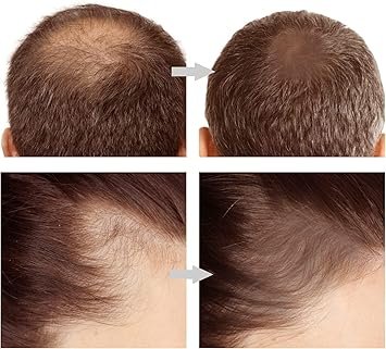 2in1 Hairline & Eyebrow Shaping Stamp - Image 3