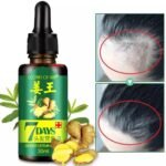 original 7 Days Hair Growth Germinal Serum Oil (30ML) thumbnail 1