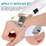 Electric Suction Blackhead Instrument Home Beauty Instrument Blackhead Pore Cleaning. thumbnail 5