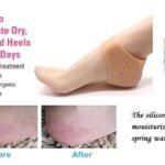 Silicone Anti-Crack Half Heel Socks Set thumbnail 3