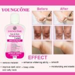 YOUNGCOME 60ml Face Body Whitening Lotion Underarm Brightening Private Underarm Body Cream Legs Whitening Parts thumbnail 1