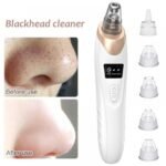 Electric Suction Blackhead Instrument Home Beauty Instrument Blackhead Pore Cleaning. thumbnail 1